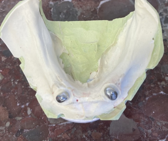 Hybridní náhrada 1