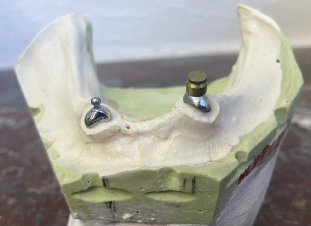 Hybridní náhrada 2