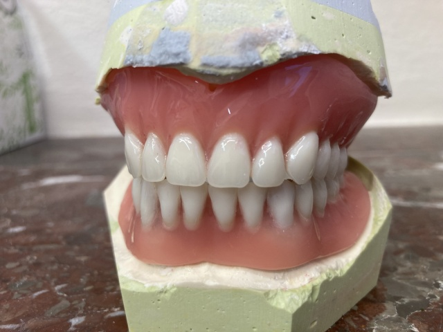 Hybridní náhrada 3