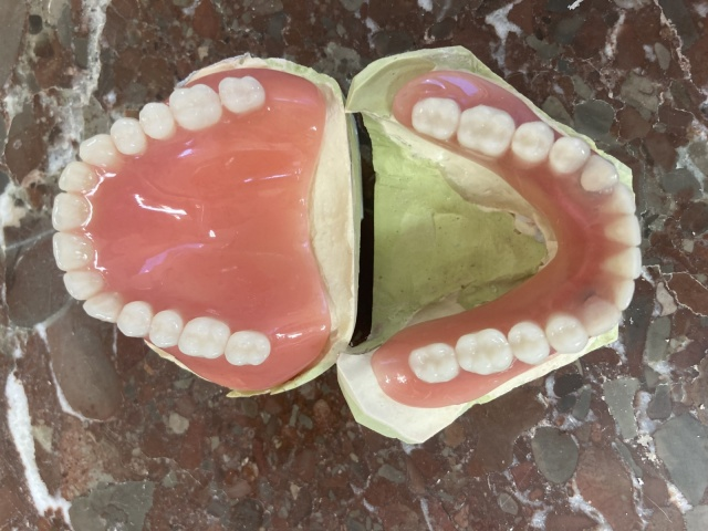 Hybridní náhrada 4