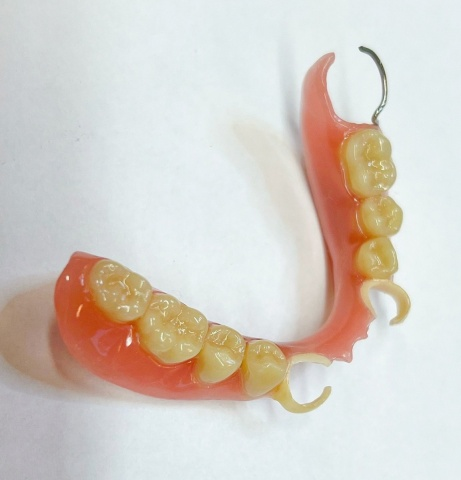 Snímatelná náhrada ACETAL 10