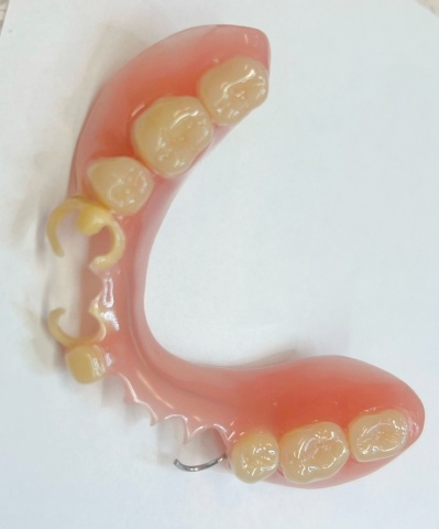 Snímatelná náhrada ACETAL 11