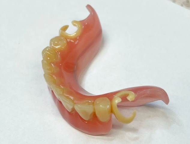 Snímatelná náhrada ACETAL 13