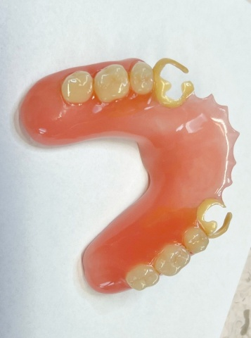 Snímatelná náhrada ACETAL 14