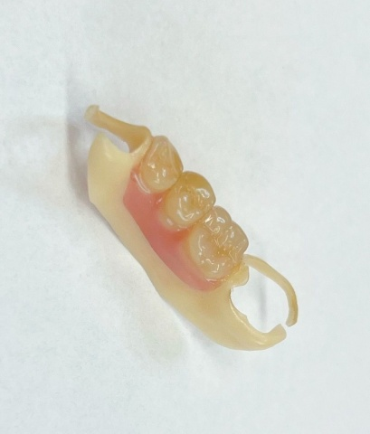 Snímatelná náhrada ACETAL 16