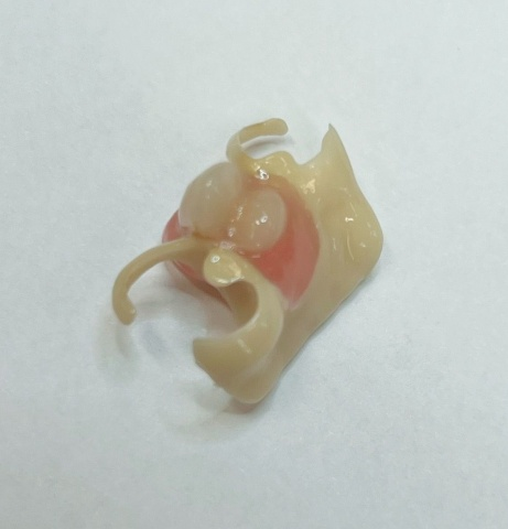 Snímatelná náhrada ACETAL 5