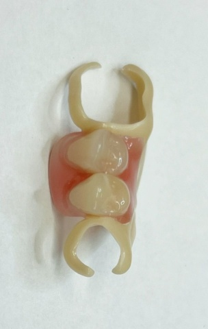 Snímatelná náhrada ACETAL 7