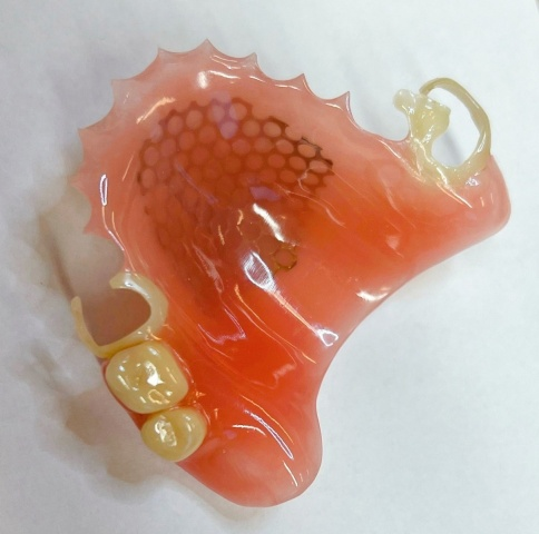 Snímatelná náhrada ACETAL 9