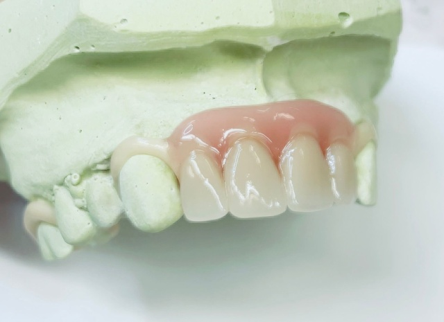 Skeletová náhrada ACETAL 8