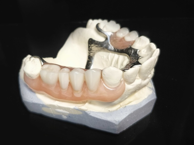 Skeletová náhrada kombinace kov a deflex 1