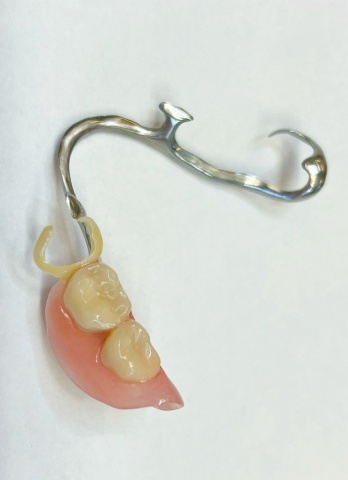 Skeletová náhrada kombinace kov a Zirlux ACETAL 5