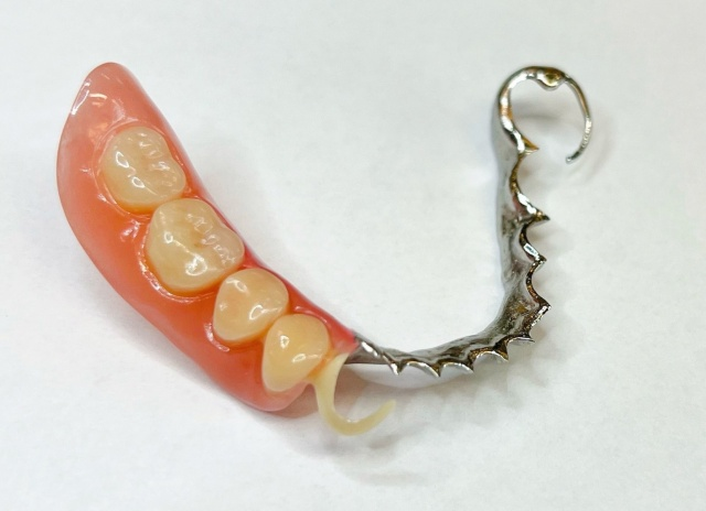 Skeletová náhrada kombinace kov a Zirlux ACETAL 6