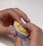 Chybí vám zub? Řešení bez broušení – digitální laboratoř Stomal